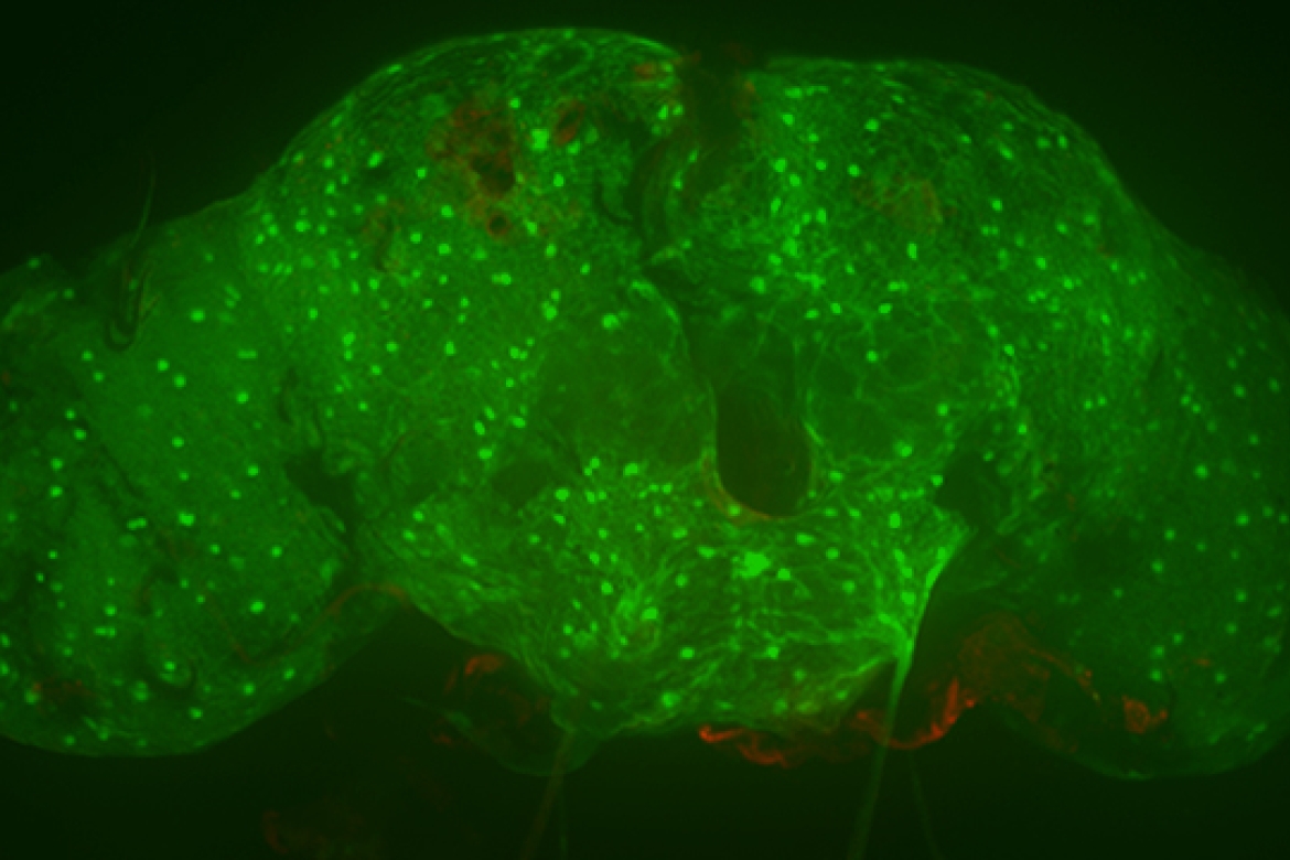 Glial cells of a fruit fly brain express green fluorescence protein, as visualized with an integrated laser scanning/spinning disk microscopy system.
